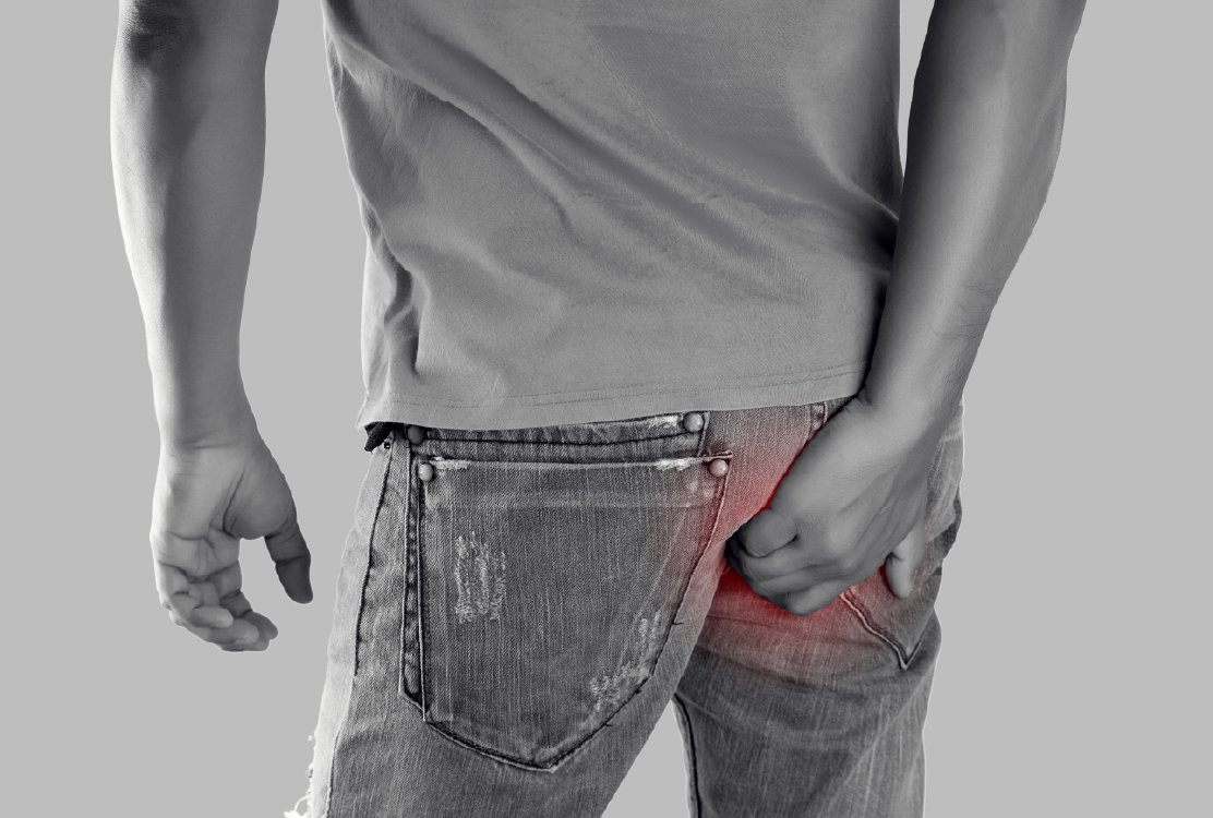 candidate_with_pain_in_ass_for_hemorrhoidectomy_in_turkey