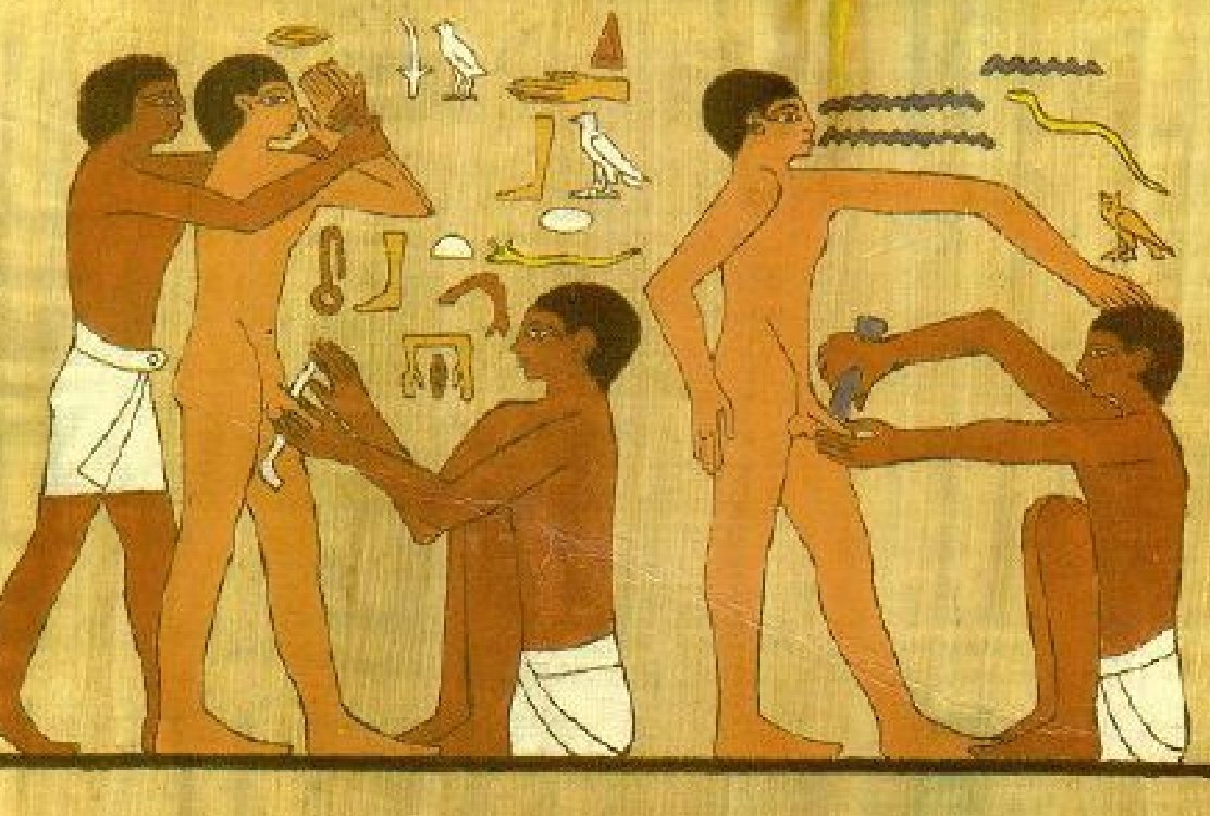 circumcision_in_ancient_egypt_for_circumcision_in_turkey