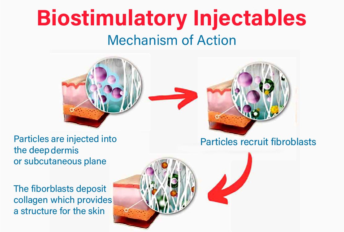 Collagen-Biostimulation-for-sculptra-in-turkey (1)
