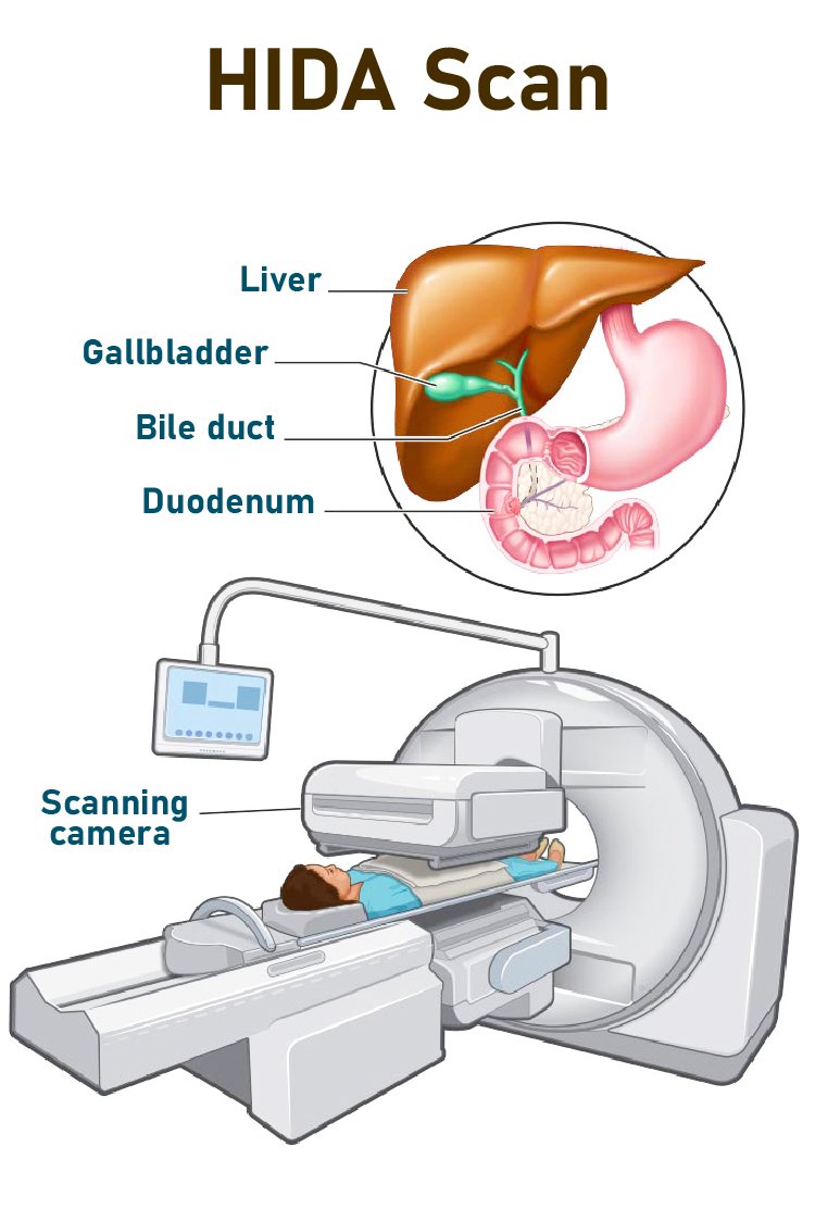 HIDA_for_gallbladder_removal_in_turkey