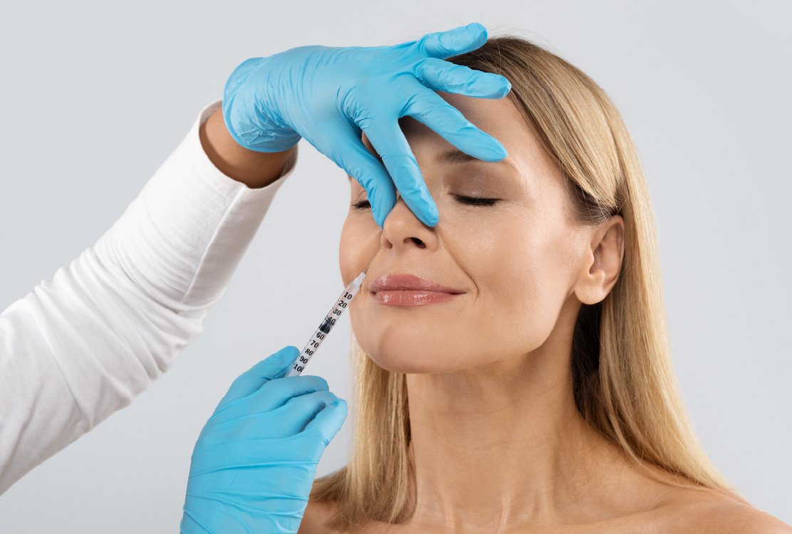 man-with-fillers-for-nasolabial-folds-treatment-in-turkey