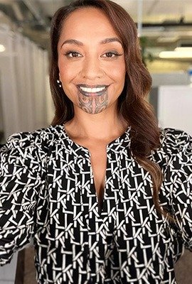 maori_woman_with_tatted_mouth_for_all_on_6_implants_in_turkey