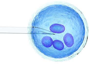 microscopic_picture_of_ovum_being_picked_for_ivf_in_turkey