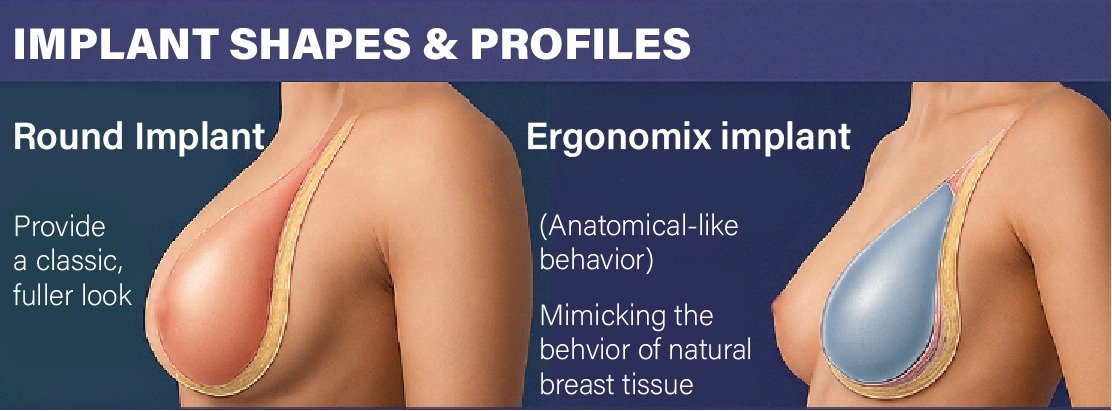 motiva_implants_in_turkey_types
