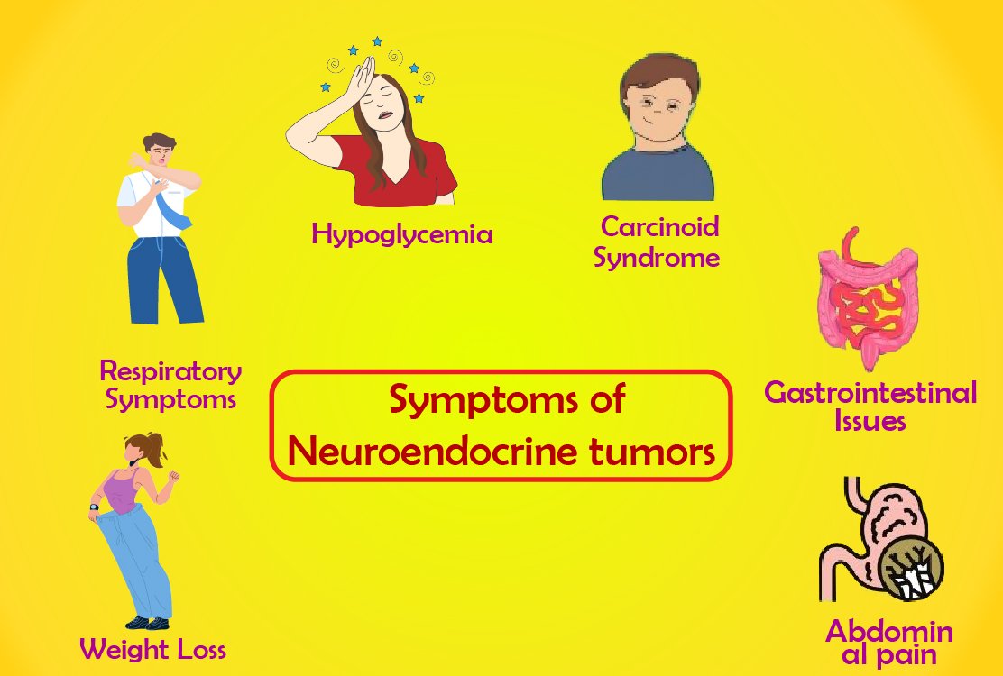 neuroendocrine-tumors-for-pancreatic-surgery-in-turkey