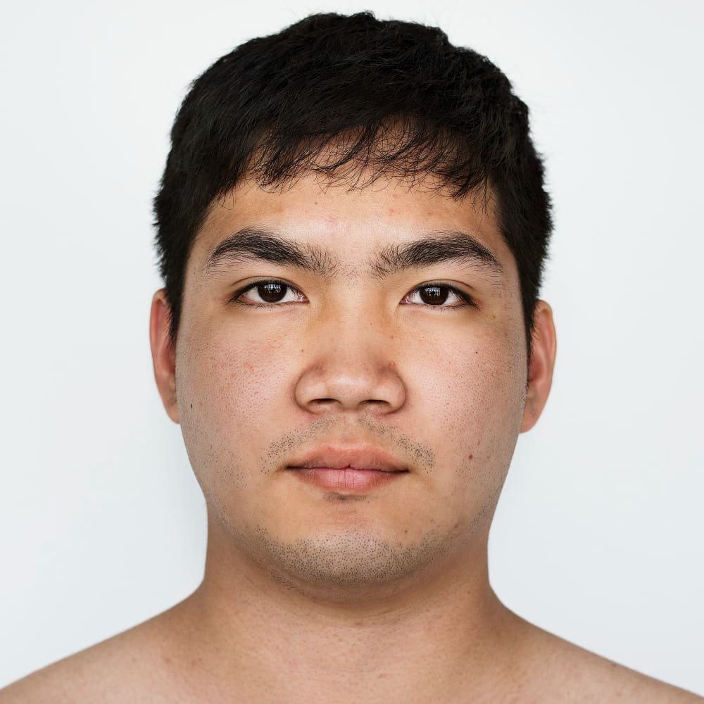 /upload/galeri/portrait_of_asian_man_with_ethnic_nose_for_ethnic_rhinoplasty_in_turkey