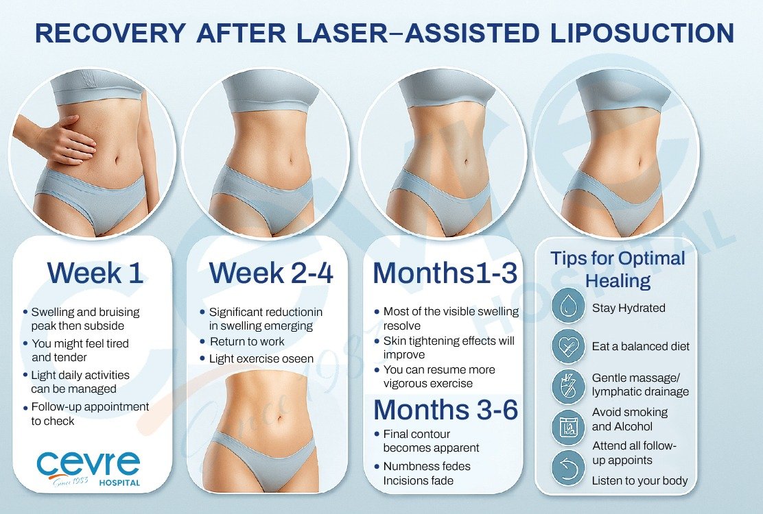 recovery_process_after_laser_assisted_surgery_in_turkey