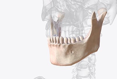 structure_of_solid_jaw_bone_for_all_on_6_dental_implants_in_turkey