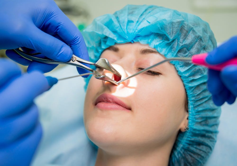surgeons_with_scalpels_doing_a_revision_rhinoplasty_surgery_in_Turkey_on_a_woman