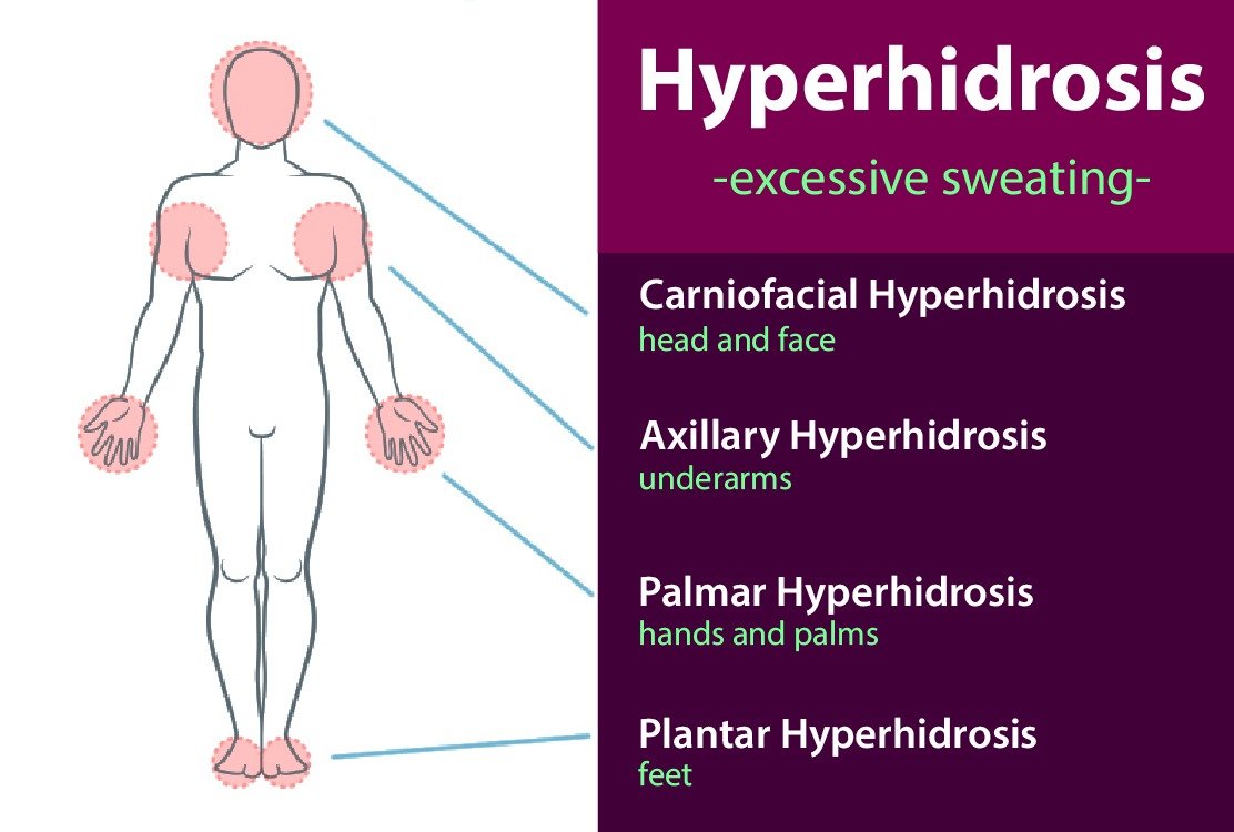 types_of_hyper_hydrosis_for_hyper_hydrosis_treatment_in_turkey