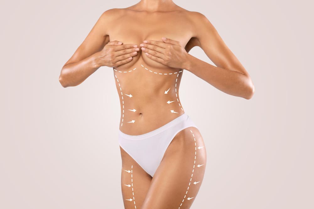woman_with_contoured_body_after_liposuction_in_turkey